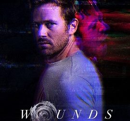 Wounds